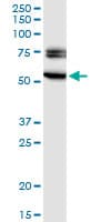 EGR2 Antibody (clone 1G5)