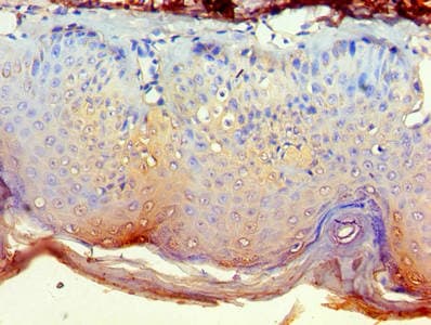 GRB4 / NCK2 Antibody (aa1-380)