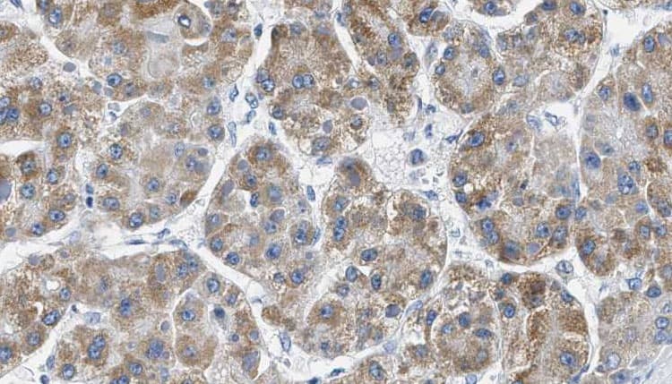 Polyclonal Rabbit anti-Human PAK1 Antibody (IHC, IF, WB)