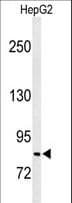 Polyclonal Rabbit anti-Human MISP / C19orf21 Antibody (aa63-91, IHC, WB)