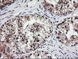 MGLL / Monoacylglycerol Lipase Antibody (clone OTI4D1)