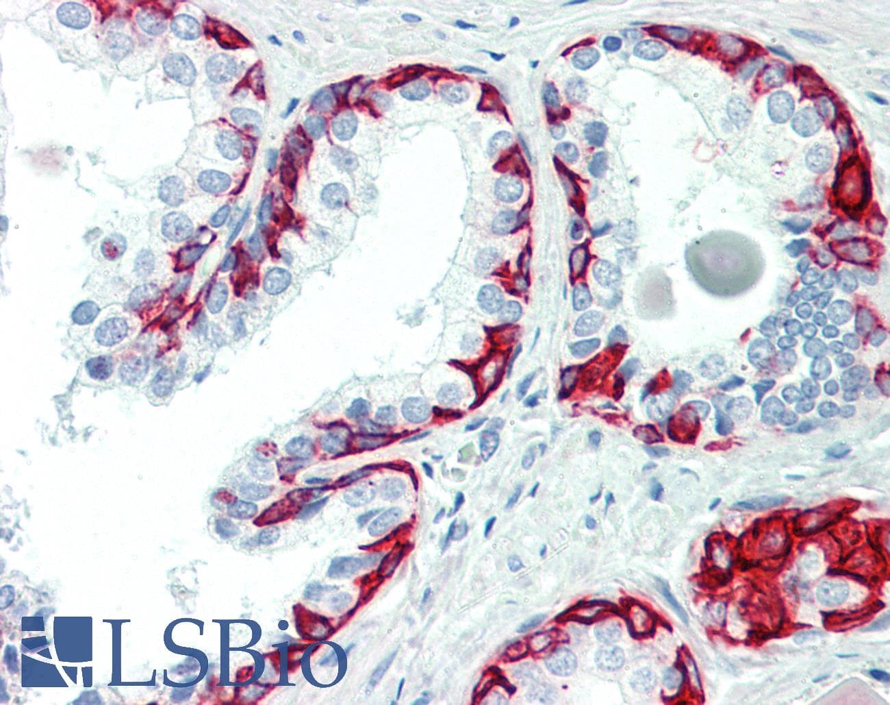 ACTRIIB / ACVR2B Antibody (aa287-336)