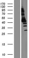 Human ACY1 / Aminoacylase 1 Protein (Over-Expression Lysate Myc-DDK (Flag))