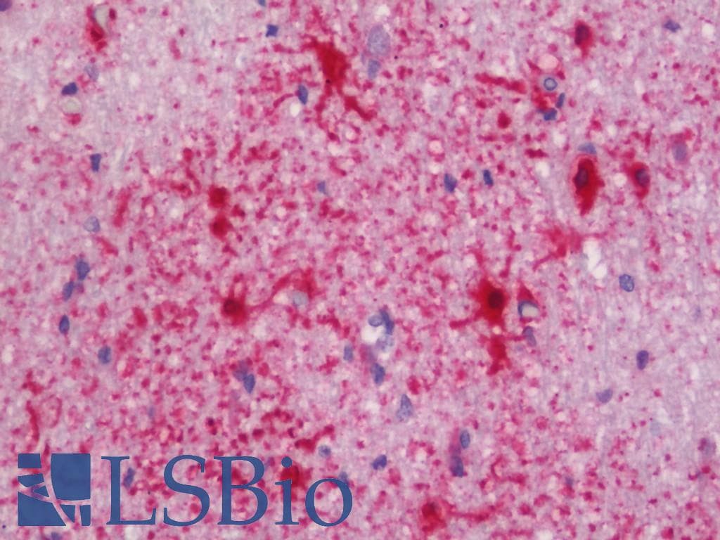 IHC-plus™ GJA1 / CX43 / Connexin 43 Antibody (aa340-390)