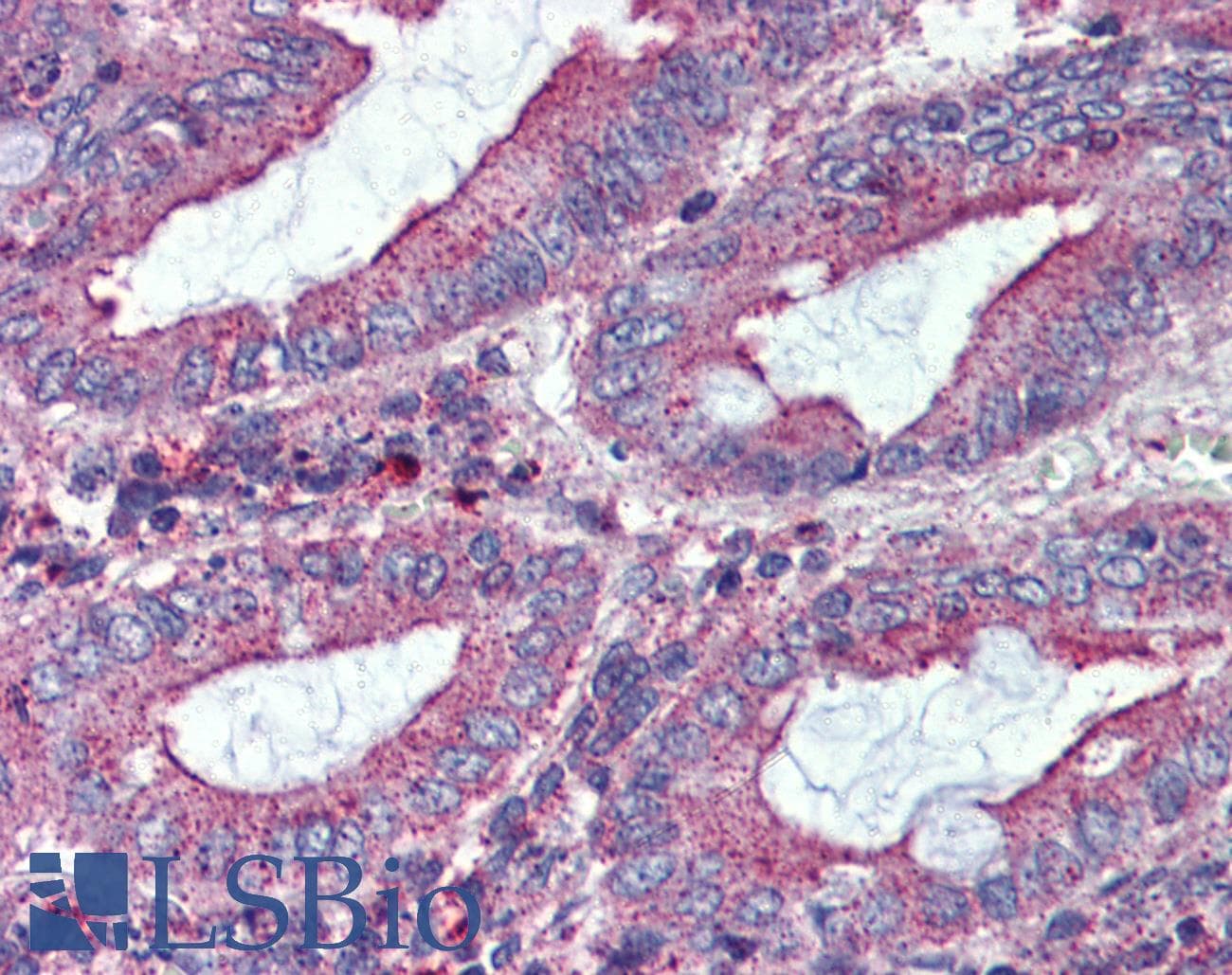 IHC-plus™ Polyclonal Rabbit anti-Human VMD2L3 / BEST3 Antibody (Cytoplasmic Domain, IHC)