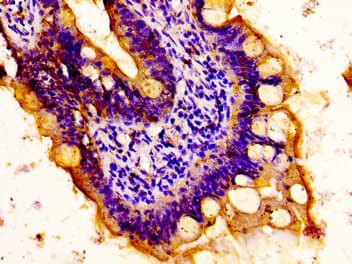 MYH14 Antibody