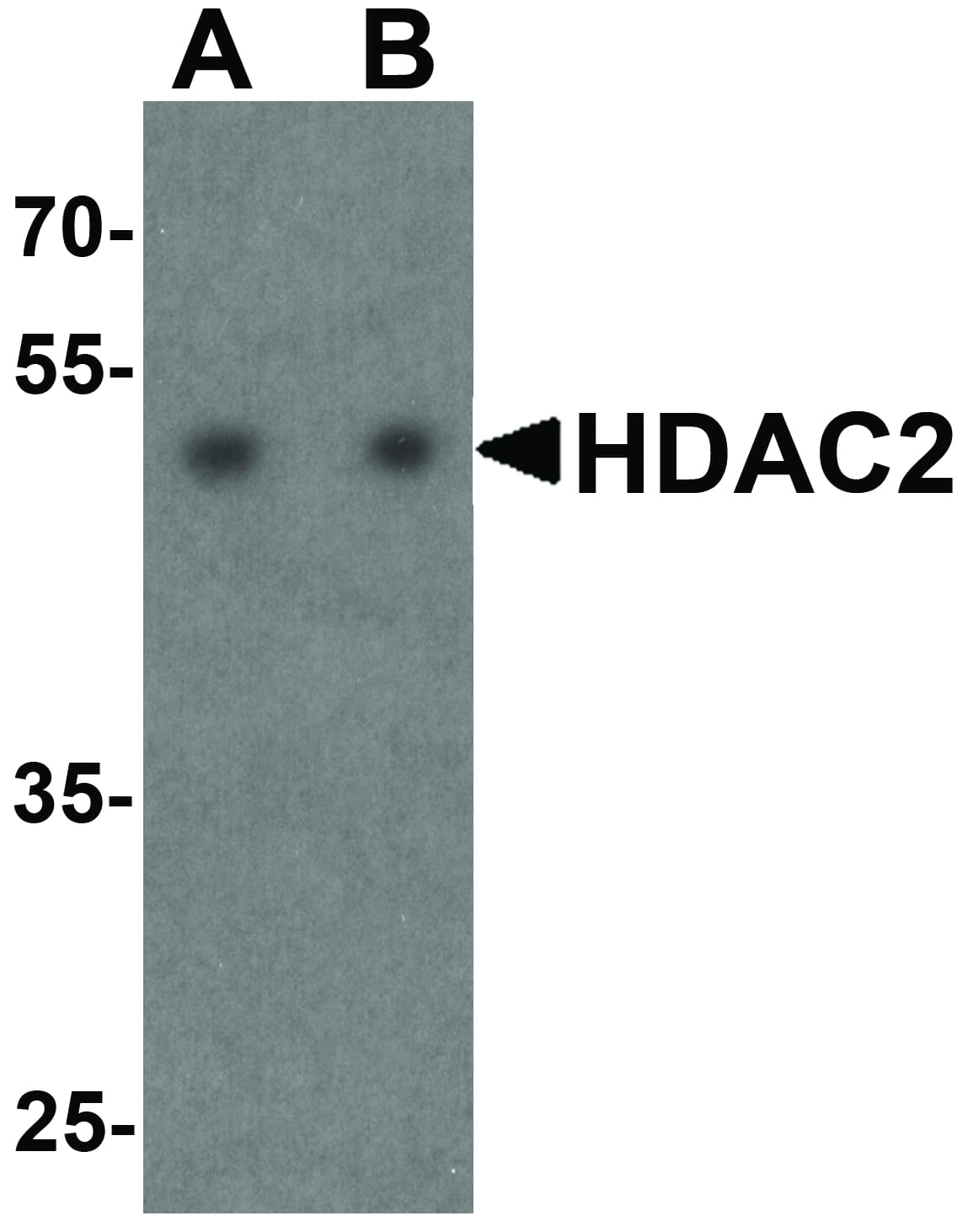 Polyclonal Rabbit anti-Human HDAC2 Antibody (IHC, IF, WB)