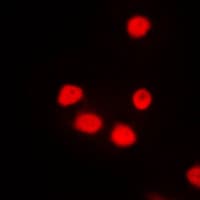 SIX6 Antibody (Internal)