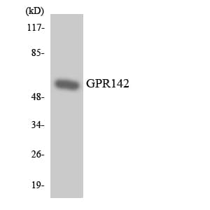 IHC-plus™ GPR142 Antibody (aa41-90)