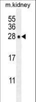 POLR3GL Antibody (aa65-93)