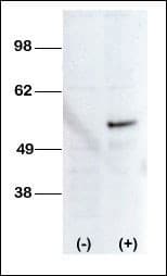 Polyclonal Rabbit anti-Human STK38L / NDR2 Antibody (aa408-437, WB)