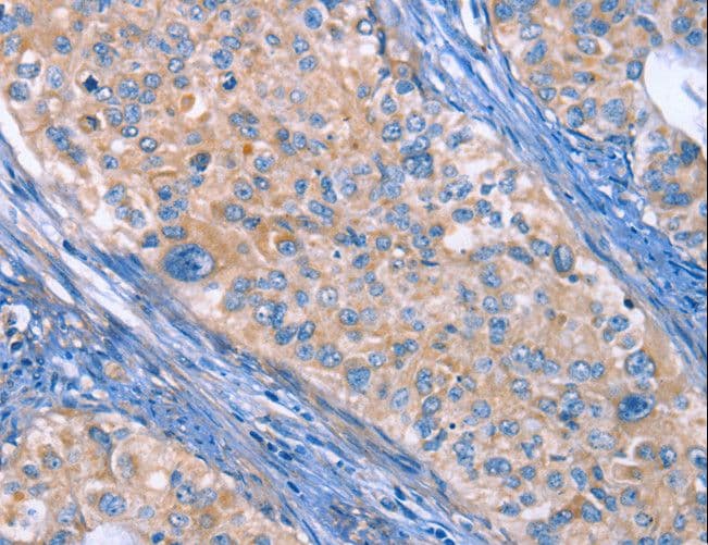 ITGB3 / Integrin Beta 3 / CD61 Antibody