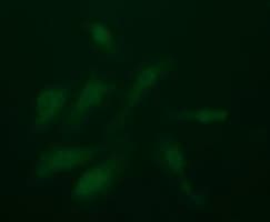 PDGFRB / PDGFR Beta Antibody (clone OTI1D1)