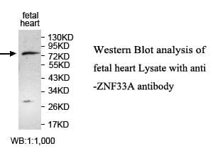 ZNF33A / KOX2 Antibody (aa453-738)