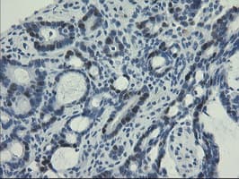UNG / Uracil DNA Glycosylase Antibody (clone OTI2F8)