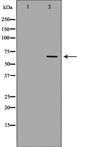 Polyclonal Rabbit anti-Human NUMBLIKE / NUMBL Antibody (IHC, IF, WB)