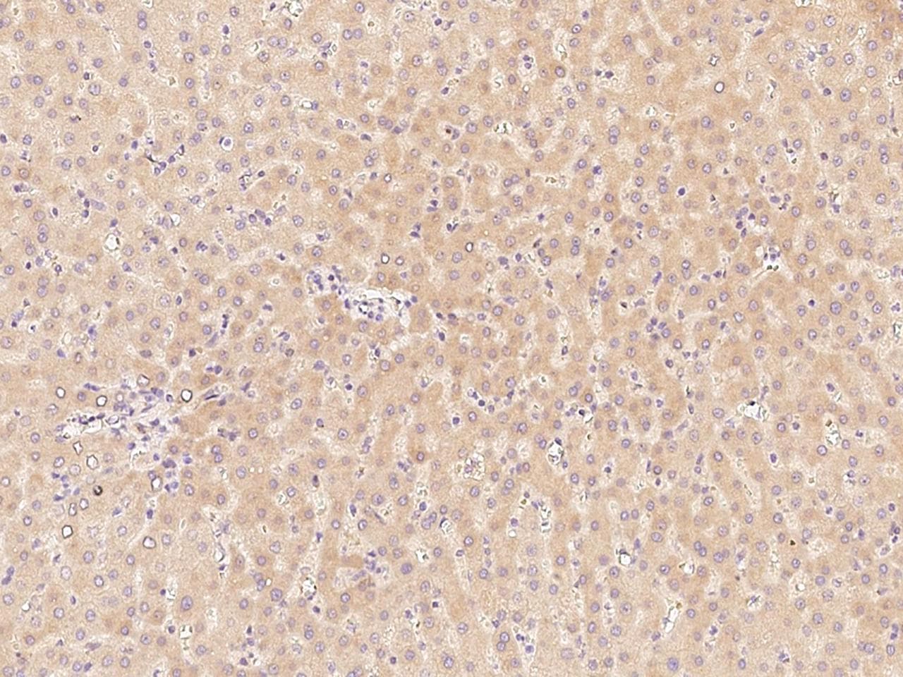 F11 / FXI / Factor XI Antibody (Preservative Free)