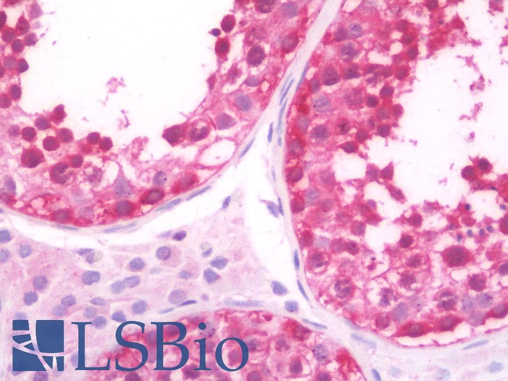 IHC-plus™ FMR1 / FMRP Antibody
