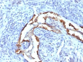 KRT8 / CK8 / Cytokeratin 8 Antibody (clone SPM538)