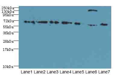 TRPM2 Antibody (aa60-119)
