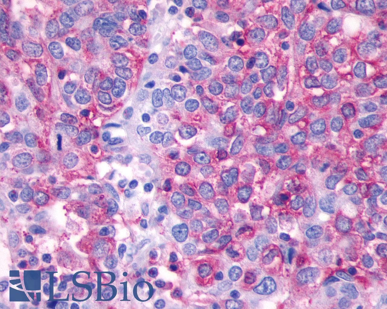 IHC-plus™ SSTR2 Antibody (Extracellular Domain)