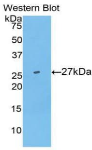 UCHL5 / UCH37 Antibody (aa27-246)