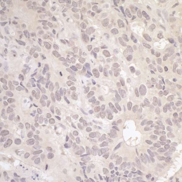RFC3 Antibody (aa80-110)