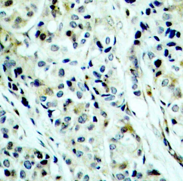 HDAC5 Antibody (phospho-Ser498)