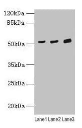 IHC-plus™ Polyclonal Rabbit anti-Human Yo / CDR2 Antibody (IHC, WB)