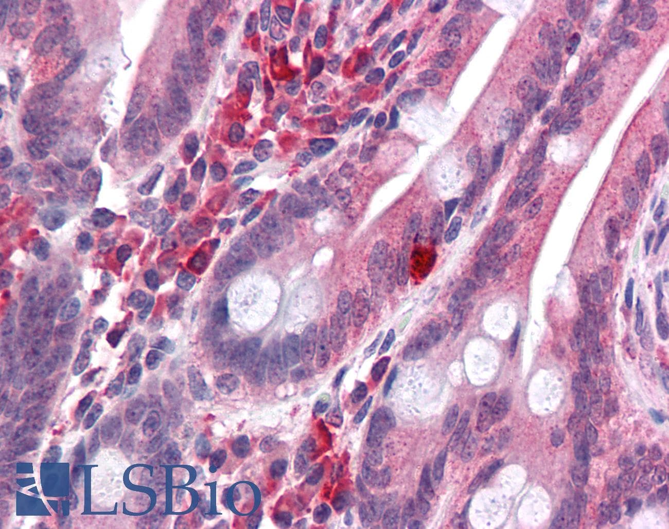 IHC-plus™ LYRM2 Antibody