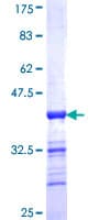Human EVI2B Protein (Recombinant GST, N-terminus)