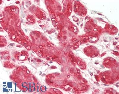 IHC-plus™ Polyclonal Rabbit anti-Human PSMA1 Antibody (IHC, IF, WB)