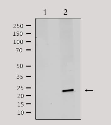 Polyclonal Rabbit anti-Human MRPL20 Antibody (IF, WB)