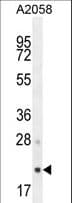 Polyclonal Rabbit anti-Human AP3S1 Antibody (aa1-30, IHC, WB)
