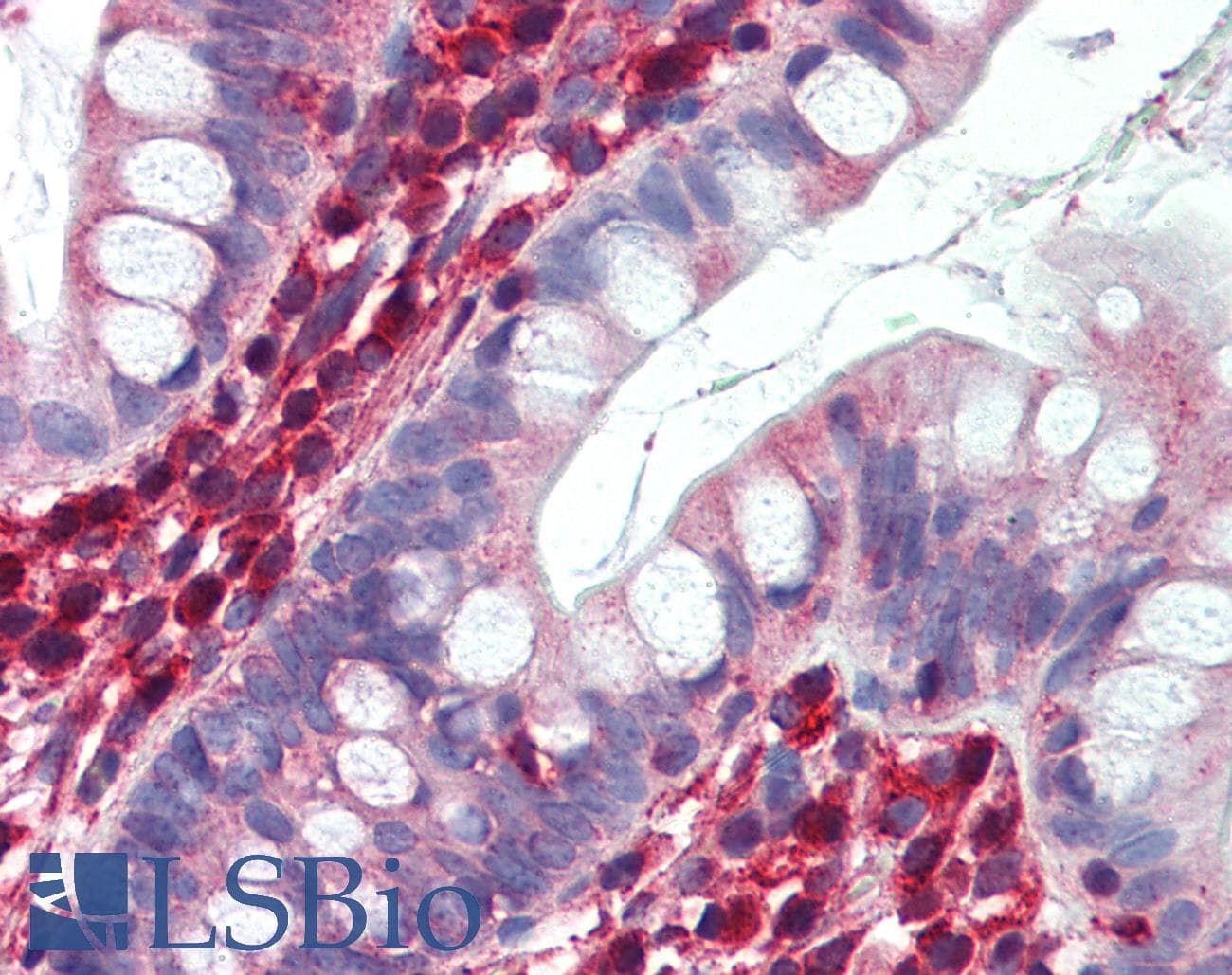 Polyclonal Rabbit anti-Human LDHB / Lactate Dehydrogenase B Antibody (C-Terminus, IHC, WB)