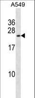 KCNMB1 Antibody (aa43-72)