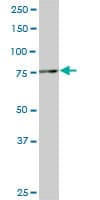 IHC-plus™ SMURF1 Antibody (clone 1D7)