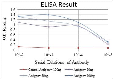 IHC-plus™ EEF2 / Elongation Factor 2 Antibody (clone 5B6)