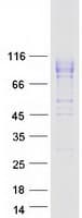 Human IL12RB1 / CD212 Protein (Recombinant Myc-DDK (Flag))