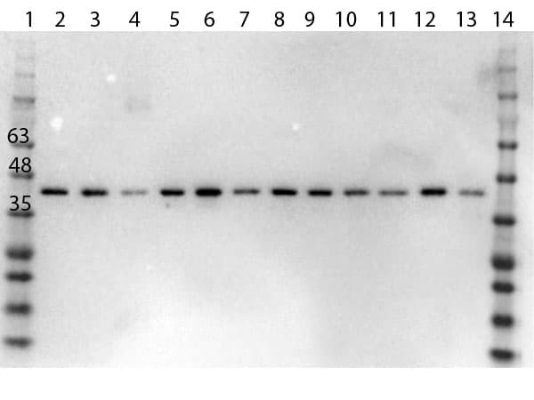 MAPK1 / ERK2 Antibody (C-Terminus)