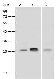 BCL2 / Bcl-2 Antibody