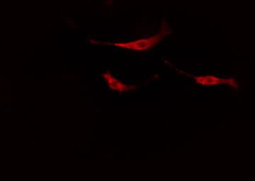 NTRK2 / TRKB Antibody (phospho-Tyr705)