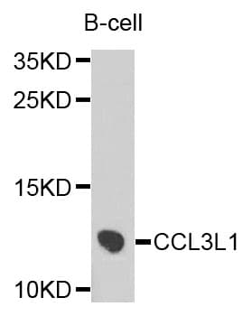 Polyclonal Rabbit anti-Human LD78 / CCL3L1 Antibody (WB)