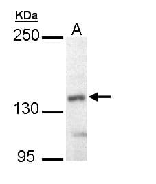 IHC-plus™ Polyclonal Rabbit anti-Human UFD2A / UBE4B Antibody (aa869-1179, IHC, WB)