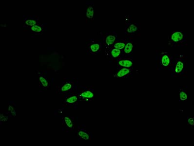HIST1H2BB Antibody