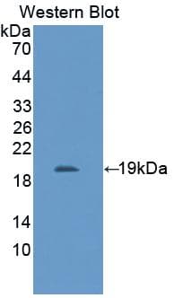 IL11RA Antibody (aa59-217, Biotin)