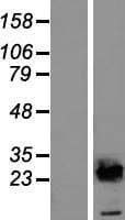 UBE2E2 / UBCH8 Protein (Over-Expression Lysate Myc-DDK (Flag))