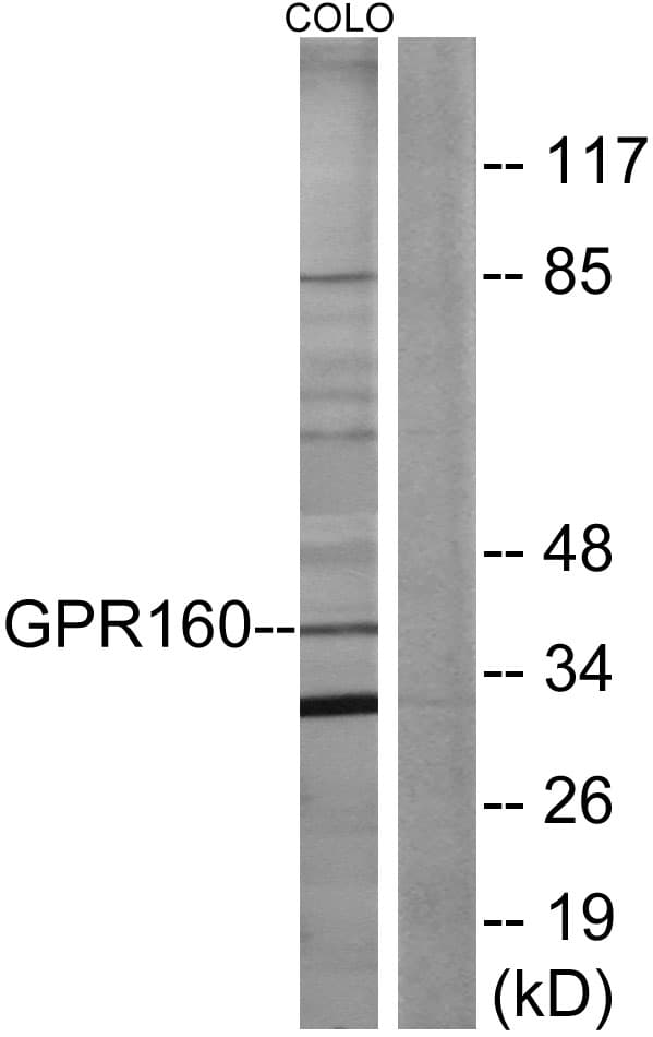 GPR160 Antibody (aa289-338)