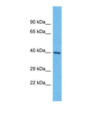 OR6K6 Antibody (C-Terminus)