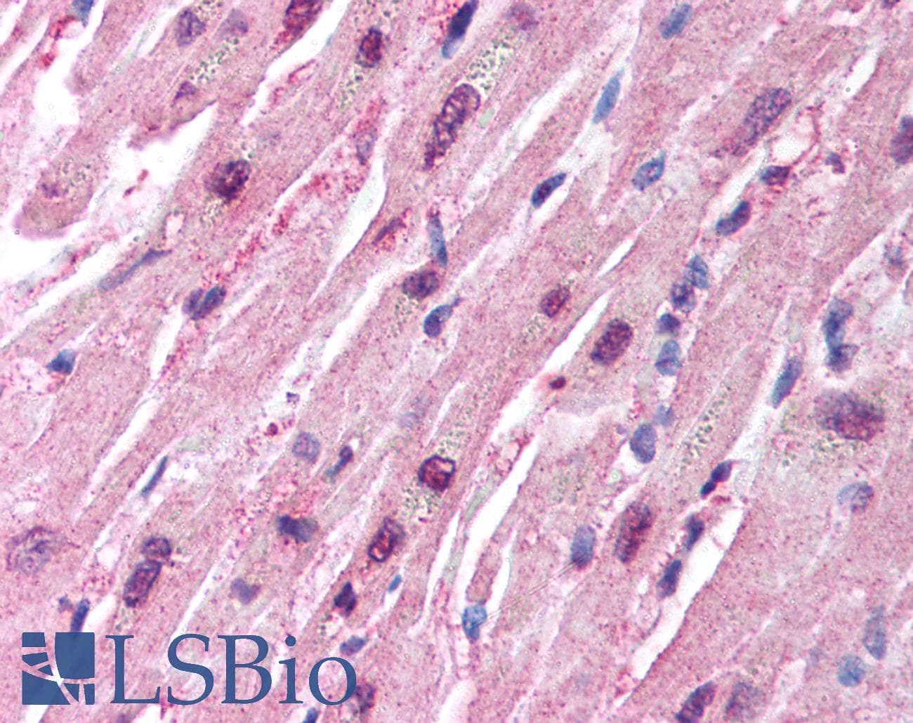 HUWE1 / ARFBP1 Antibody